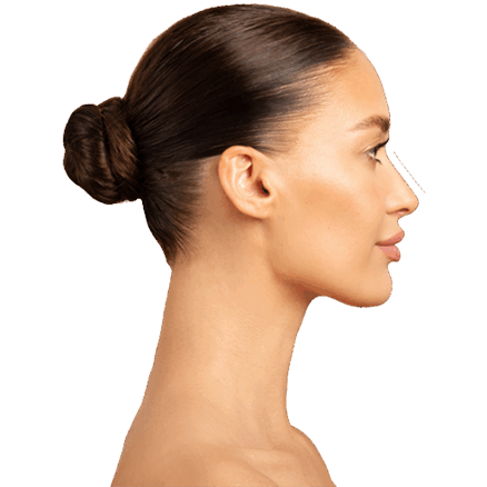 Rhinoplasty fillers: A Top Way To Best Shapes