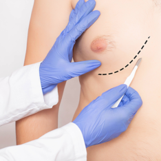 männerbrust loswerden​