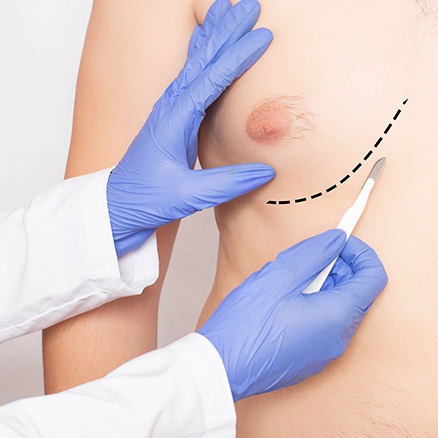 Männerbrust loswerden: 7 bewährte Fakten für Ihren besten Erfolg