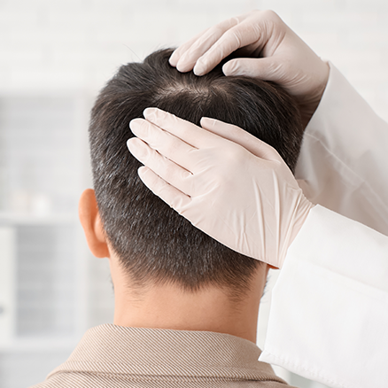 FUE Haartransplantation: 5 beste Heilungstipps