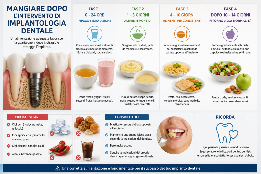 Infografica riassuntiva sulle fasi della dieta e della masticazione dopo impianto dentale.