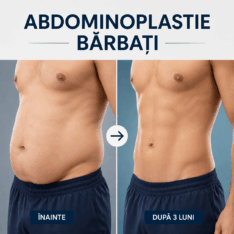 Abdominoplastie Barbati