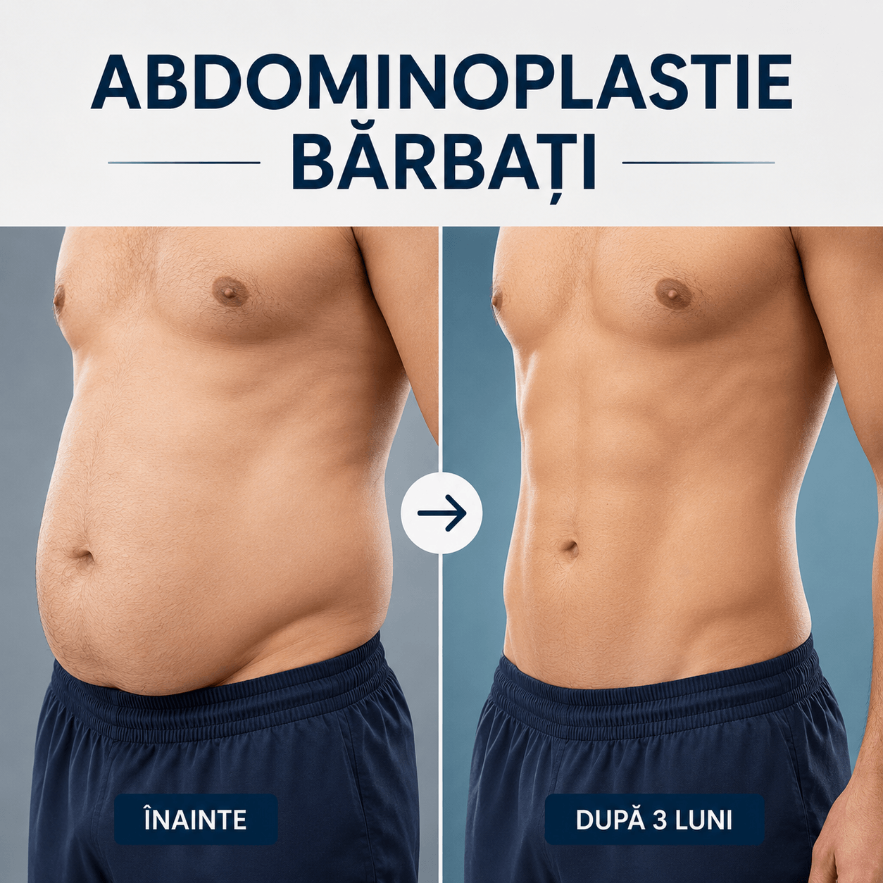 Abdominoplastie Barbati: 5 Reguli de Aur