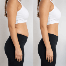 Tablier Abdominal